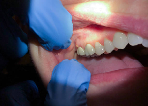 Best Emergency Cosmetic Dentistry in Ball Pond, CT